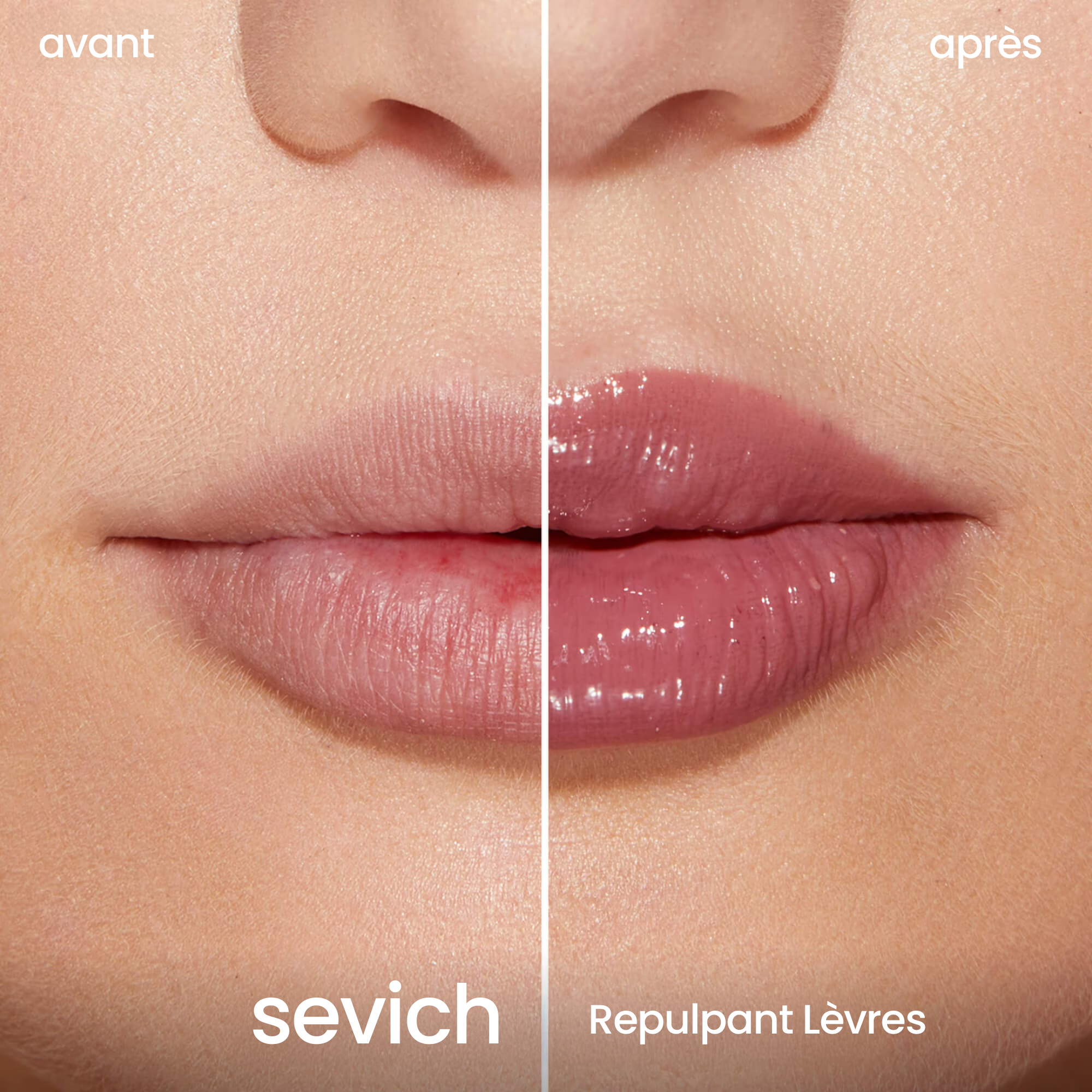 Repulpant Lèvres